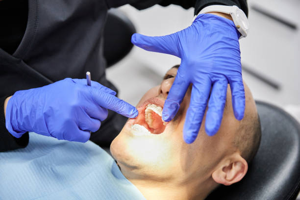Teeth Whitening in FL